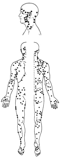 de TriggerPoints